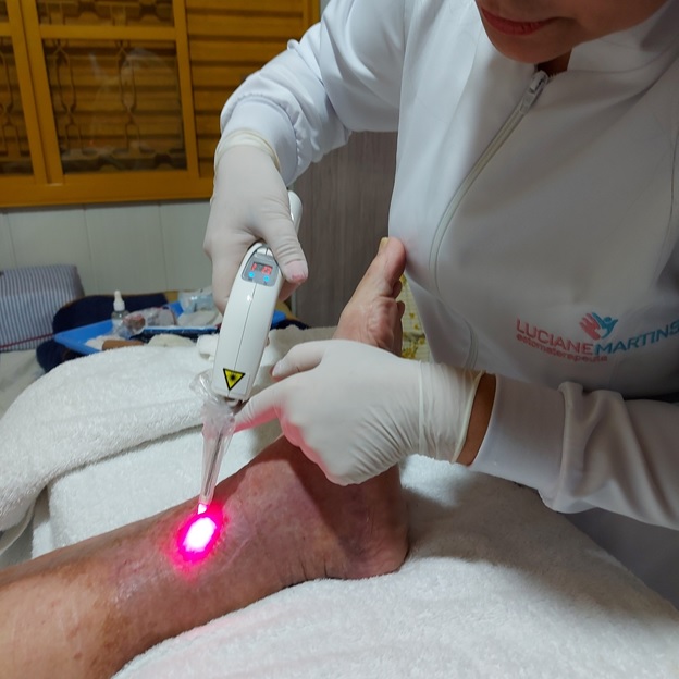 Laserterapia